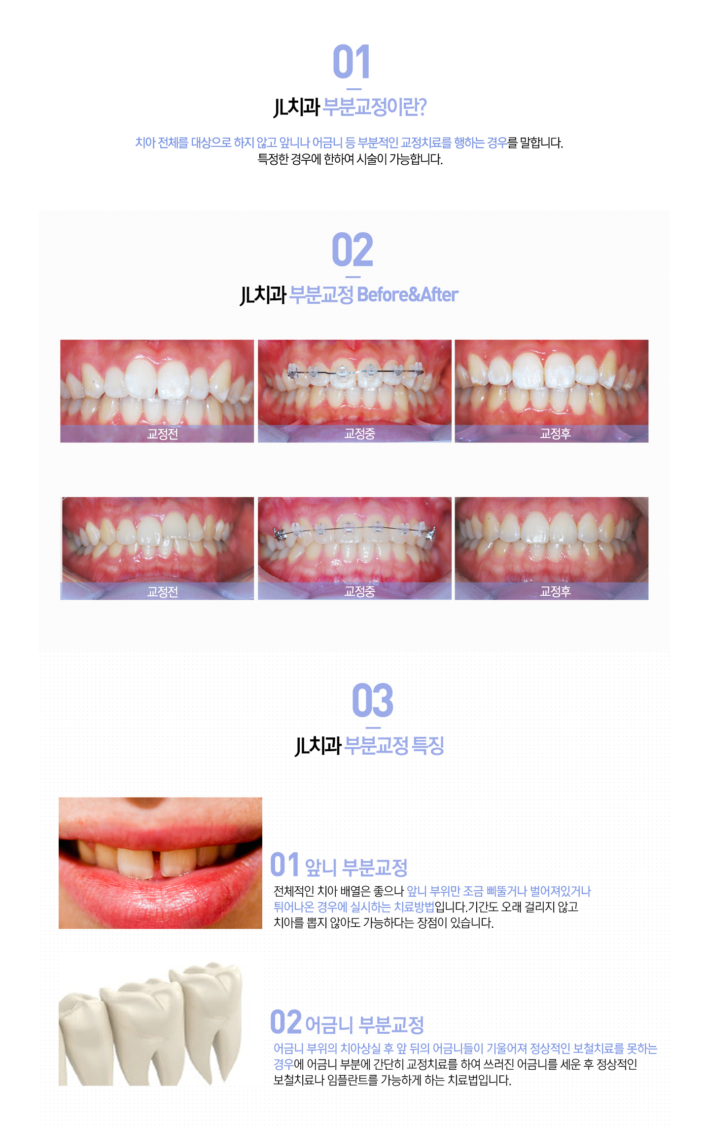 부분교정